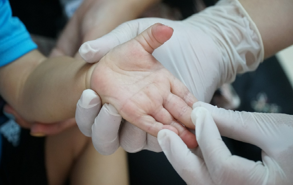 Bệnh tay, chân, miệng - nguyên nhân, triệu chứng, cách chẩn đoán và điều trị hiệu quả cho mọi lứa tuổi Bệnh tay, chân, miệng - nguyên nhân, triệu chứng, cách chẩn đoán và điều trị hiệu quả cho mọi lứa tuổi